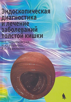 Эндоскопическая диагностика и лечение заболеваний толстой кишки
