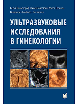 Ультразвуковые исследования в гинекологии