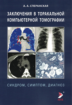 Заключение в торакальной компьютерной  томографии. Симптом, синдром, диагноз
