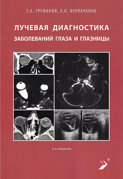 Лучевая диагностика заболеваний глаза и глазницы
