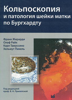 Кольпоскопия и патология шейки матки по Бургхардту