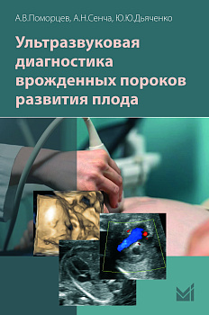 Ультразвуковая диагностика врожденных пороков развития плода.