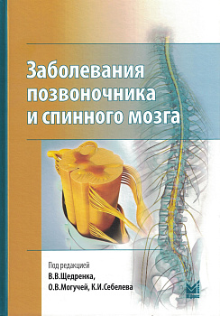 Заболевания позвоночника и спинного мозга.