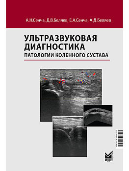 Ультразвуковая диагностика патологии коленного сустава