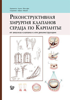 Реконструктивная хирургия клапанов сердца по Карпантье