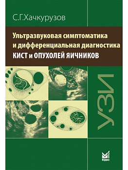 Ультразвуковая симптоматика и дифференциальная диагностика кист и опухолей яичников